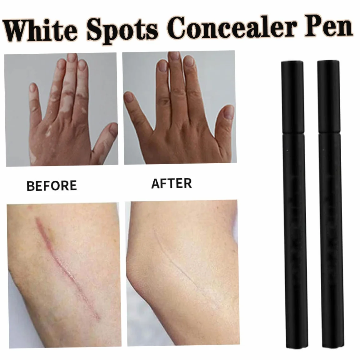 Concettore bastoncino correttore macchie bianche penna trucco vitiligine