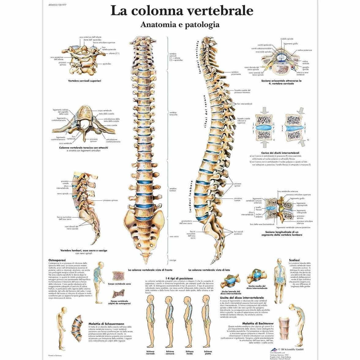 3B Scientific VR4152L la Colonna Vertebrale, Anatomia e Patologia